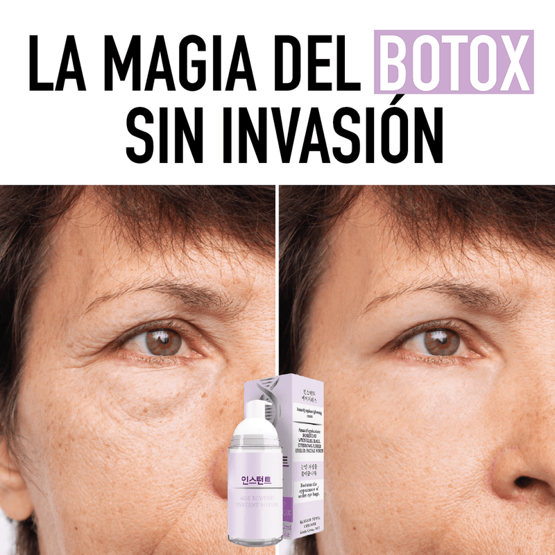 Crema Botox Atiarruga