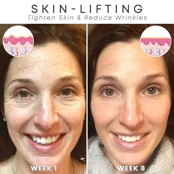 Crema Botox Atiarruga
