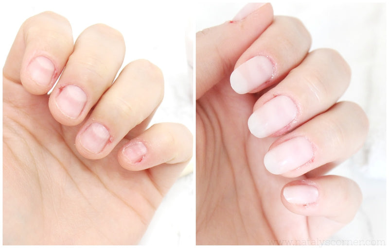 3xEndurecedor NailFort