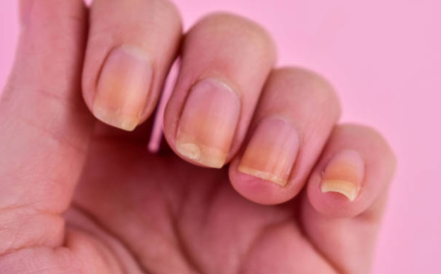 3xEndurecedor NailFort